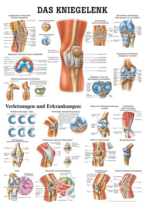 anat. Lehrtafel: Das Kniegelenk 70 x 100 cm, Papier